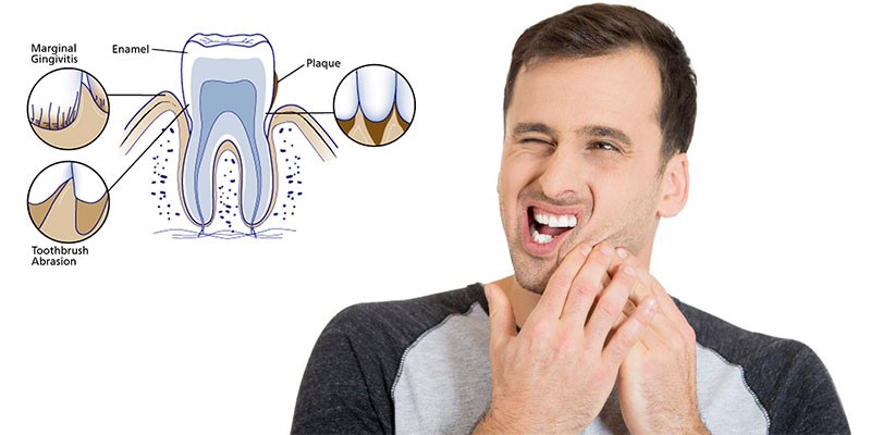 3cr2frf3t4v3t5tb67nn8mio89o Understanding Teeth Sensitivity: Causes, Symptoms, Treatments, and Prevention